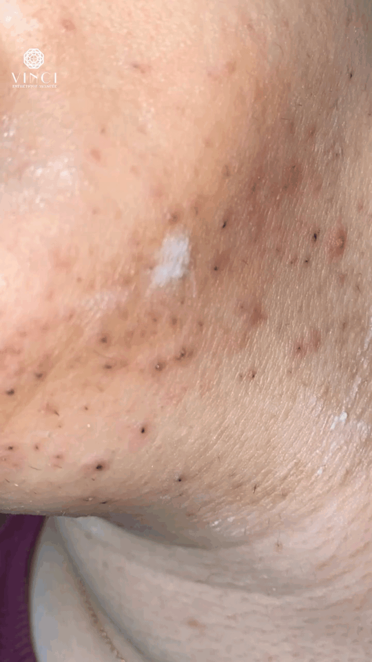 vinci_esthetique_avancee_1771783616_3838320038046957523_5929605667