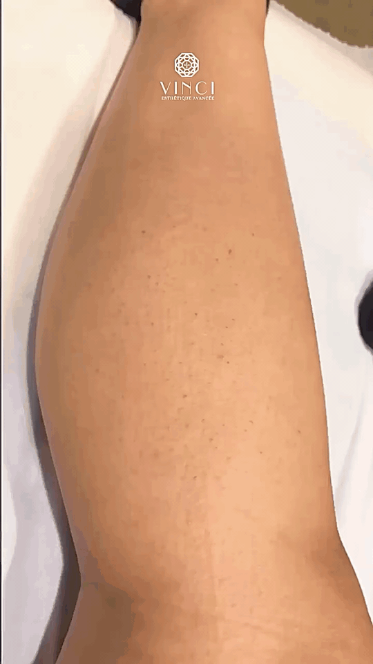 vinci_esthetique_avancee_1777052554_3882520275200070573_5929605667
